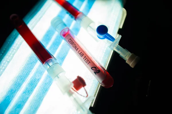Professionell Läkare Eller Laboratorietekniker Som Håller Blodprov Med Nya Nya — Stockfoto