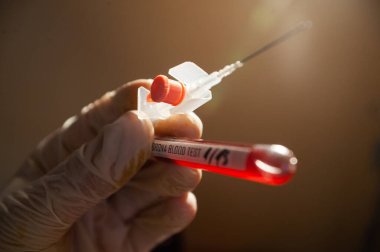 Corona virüsünü analiz etmek ve aşı üretmek için bir şişede kan örneği. Corona virüsü salgını