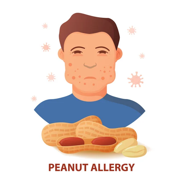 Problema dos sintomas da alergia da porca. Caráter inchado do homem. Conceito da pessoa da anafilaxia. — Vetor de Stock