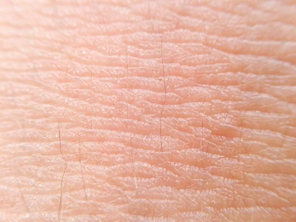 Background Human Skin — Stock Photo, Image