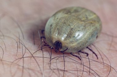 Kene kan insan derisi üzerinde oturma dolu.