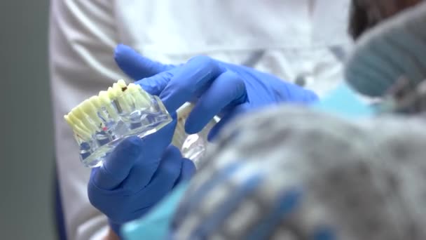 Manos sosteniendo una mandíbula modelo médico en guantes azules progreso de la implantología dental — Vídeo de stock