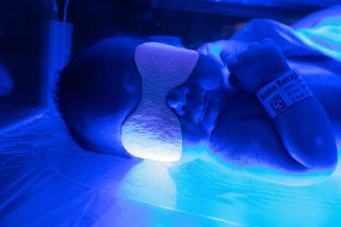 UV mavi ışık tedavisi altında küçük bir koy.