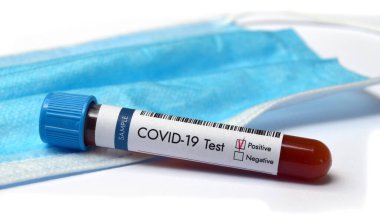 Koronavirüslü test tüpü kan testi pozitif sonuç verdi. Arka planda yüz maskesi var.