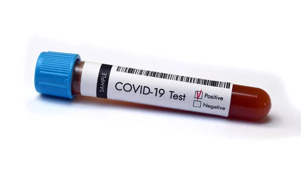 Flaconcino Della Provetta Con Coronavirus Risultato Positivo Test Del Sangue — Foto Stock