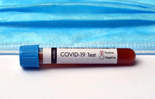 Tubo Ensayo Con Prueba Coronavirus Muestra Sangre Resultado Positivo —  Fotos de Stock