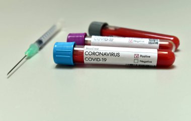 Coronavirus Covid 19, aşı araştırmalarının Covid-19 'da test edildiği laboratuardaki araştırma tüpünden pozitif kan örneği aldı. Yakın plan..