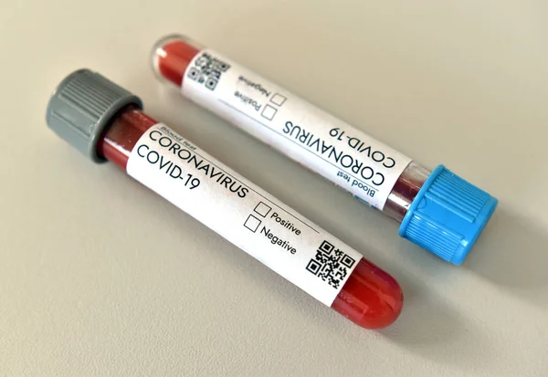 Coronavirus Covid 19, aşı araştırmalarının Covid-19 'da test edildiği laboratuardaki araştırma tüpünden pozitif kan örneği aldı. Beyaz arkaplanda yakın plan.