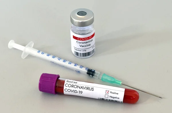 Коронавірус Covid Інфікований Зразок Аналізу Крові Дослідницькій Трубці Лабораторії Дослідження — стокове фото