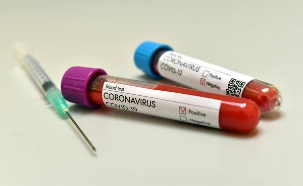 Coronavirus Covid 19, aşı araştırmalarının Covid-19 'da test edildiği laboratuardaki araştırma tüpünden pozitif kan örneği aldı. Beyaz arkaplanda yakın plan.