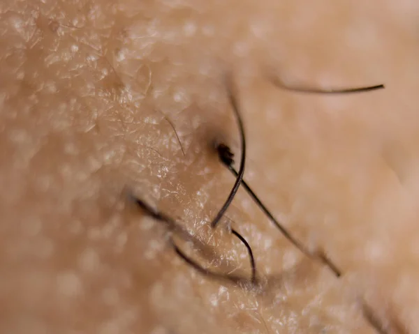 Süper makro deri ve saç detayı