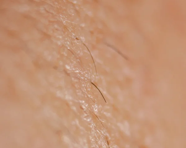Σούπερ Μακροεντολή Δέρμα Και Λεπτομέρεια Των Μαλλιών — Φωτογραφία Αρχείου