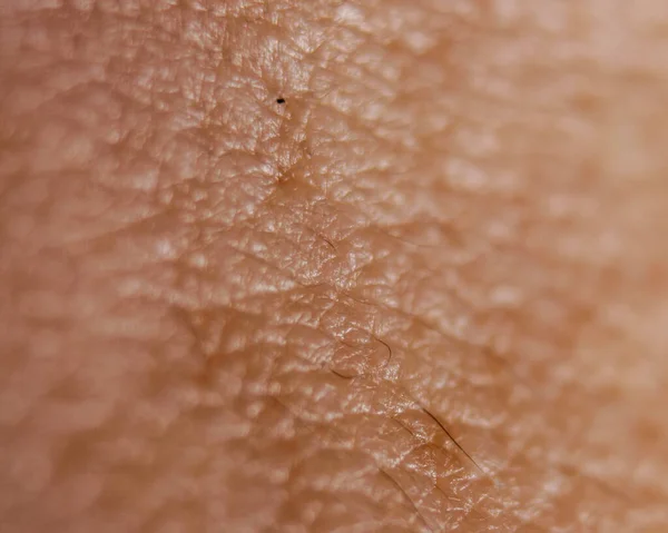 Super Macro Skin Hair Detail — Stock Photo, Image