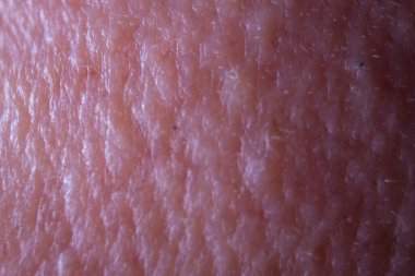 makro deri detayı ve siyah başlıklar