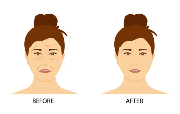 Mujer madura cara antes y después — Foto de Stock