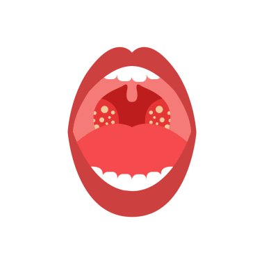 bademcik iltihabı vektör renk simgesi