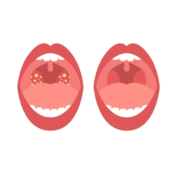 Vector: screaming mouth | Screaming mouth vector illustration — Stock ...
