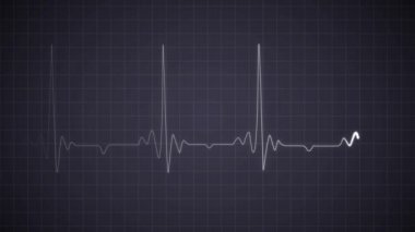EKG Nabız Kaydı 'nda kalp atışı. Kalp durması. Gerçekçi Kalp Ritmi Sağlık Hizmetleri 