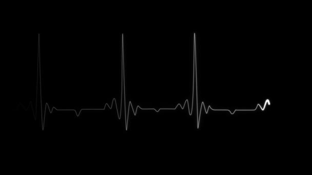 Pulzus vonal szívverés a fekete háttér. Szívmegállás. Realisztikus animált szívritmus Kardiogram Orvosi kutatás — Stock videók