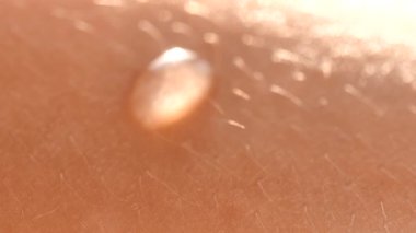 Genç, sağlıklı insan derisine su damlası dökülüyor. Vücut Doku Yenilenmesi. Cilt Nemlendirici Konsepti