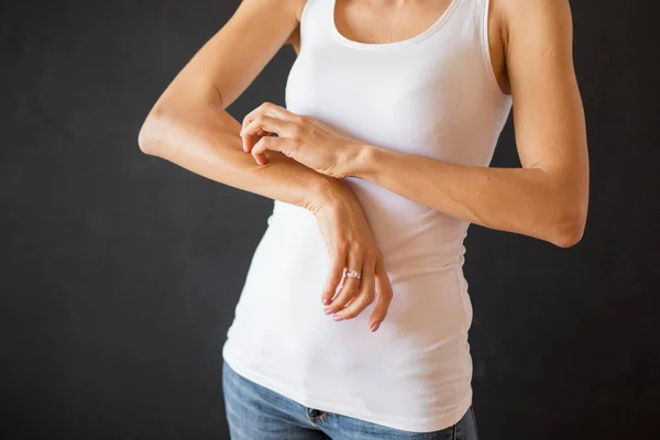 Vrouw Met Huid Eczeem Probleem — Stockfoto