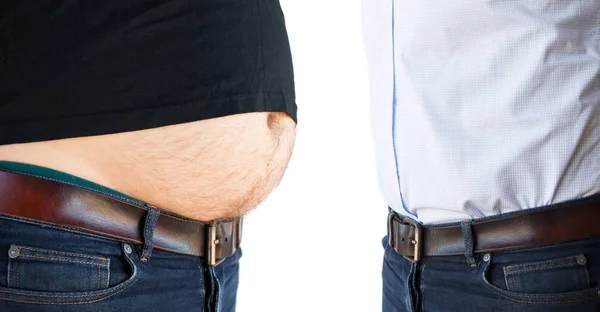 Hombre Antes Después Liposucción — Foto de Stock