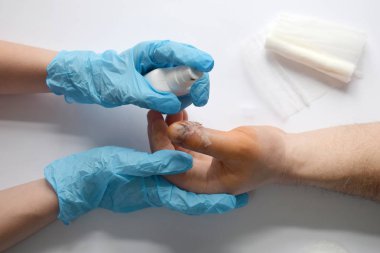 Doktorlar erkek elini büyük parmağında kanlı bir yarayla tutuyorlar. Doktor hastayı muayene ediyor. Hasta tezahüratı ve desteği. Antiseptik ile yara tedavisi.