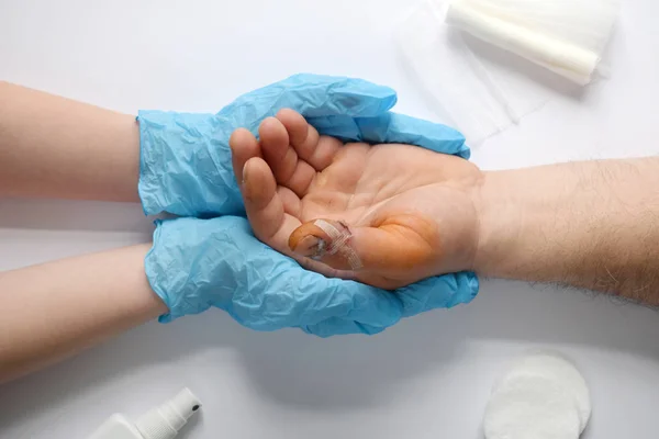 Médicos mãos segurando mão masculina com sangrento golpe no dedo grande. Exame médico do paciente. Animar e apoiar o paciente. Tratamento de feridas com anti-séptico . — Fotografia de Stock