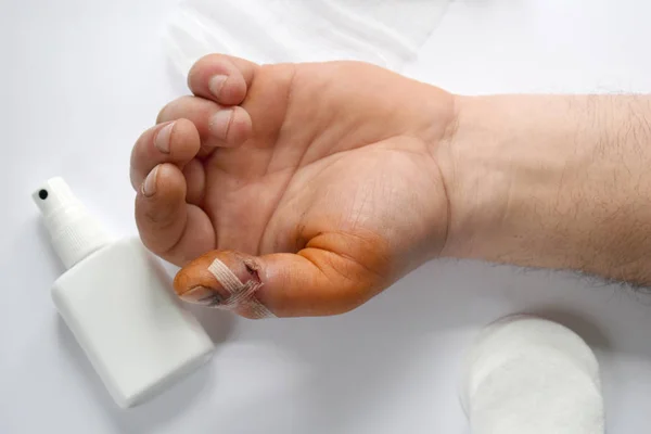 Mão masculina com um corte sangrento no dedo grande. Exame médico do paciente. Animar e apoiar o paciente. Tratamento de feridas com anti-séptico . — Fotografia de Stock