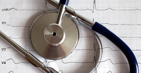 Gyönyörű Sztetoszkóp Kardiogrammal Orvosi Fogalom Egészség — Stock Fotó