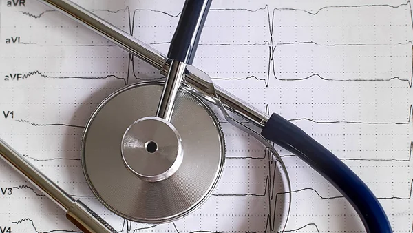 Gyönyörű Sztetoszkóp Kardiogrammal Orvosi Diagnosztika — Stock Fotó