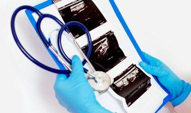 Ultrason sonuçlarına bakan bir erkek doktorun elleri. İlaç.
