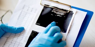 Ultrason sonuçlarına bakan bir erkek doktorun elleri..
