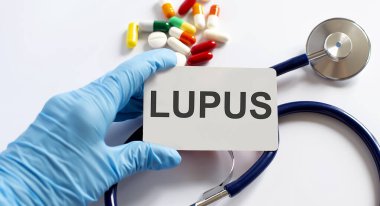 Lupus malzemeleri, haplar, steteskop yazılı kart. Tıbbi konsept.