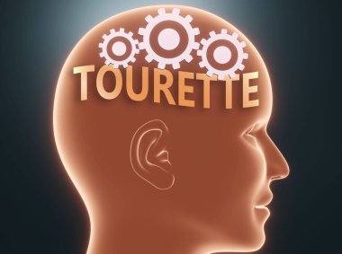 Tourette insan zihninin içinde Tourette kelimesi olarak resmedilmiş. Tourette 'in, insanların düşünebileceği ve davranışlarını etkileyen 3 boyutlu bir illüstrasyon olduğunu sembolize eden çarklı bir kafanın içinde.