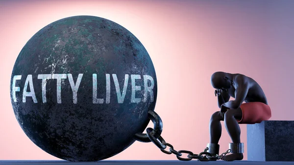 命の重みとして脂肪肝 脂肪肝が苦しみを引き起こす可能性があることを示すために囚人ボールに接続されているチェーンの人によって象徴され 3Dイラスト — ストック写真