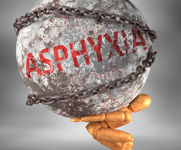 Asphyxia and hardship in life - pictured by word Asphyxia as a heavy weight on shoulders to symbolize Asphyxia as a burden, 3d illustration