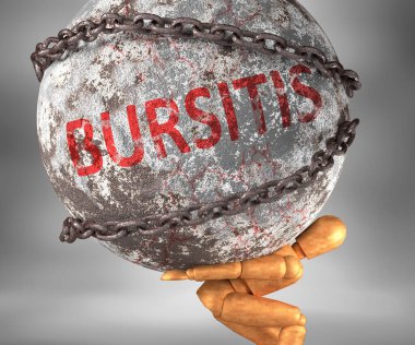 Bursitis ve hayattaki zorluklar, Bursitis 'i bir yük olarak sembolize etmek için omuzlarda ağır bir yük olarak tasvir edilir.