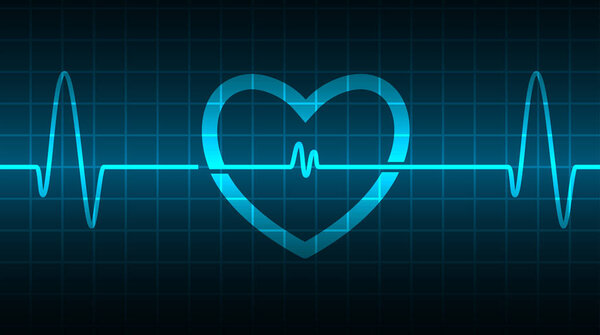 сердцебиение на кардиограмме