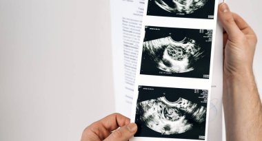 Ultrasonla yakın çekim yapan adamın elleri. Tıbbi konsept. Seçici odak