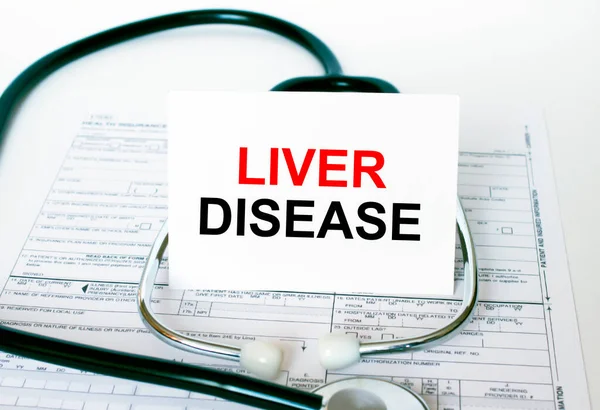 Text Liver Disease on the white card with the stethoscope and medical documents. Medical concept photo