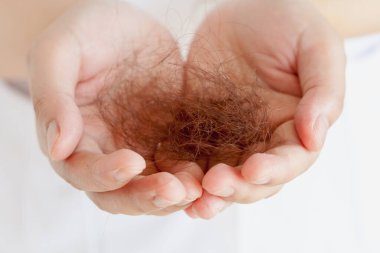 Saç kaybı, el ele tutuşmalar, dökülmüş saçlar.