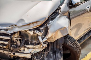 Trafik kazası geçmişi