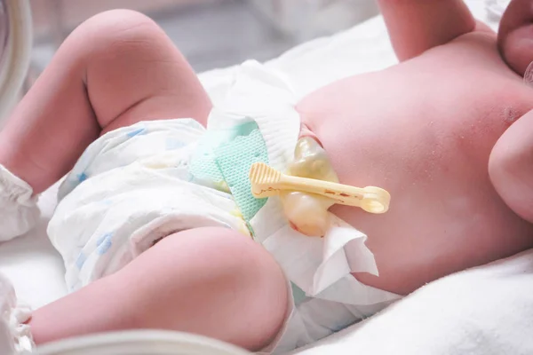 Newborn Baby Navel Close — Stock Photo, Image