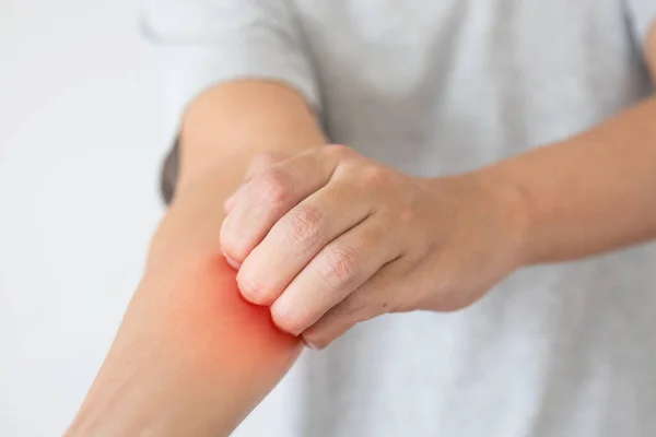 Jonge Aziatische Man Jeuk Krassen Arm Van Jeukende Droge Huid — Stockfoto