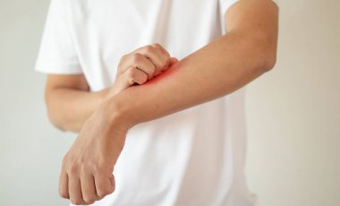 Kaşındıran ve kaşındıran bir adam kaşındıran kuru cilt egzama dermatiti.