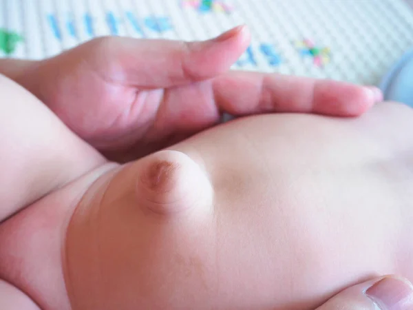 Ombligo Bebé Con Hernia Umbilical — Foto de Stock