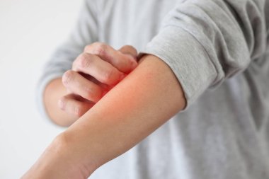 Genç Asyalı adam kaşınıyor ve kolunda kaşındırıyor kuru cilt egzama dermatiti yüzünden.