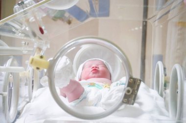 Yeni doğmuş bebek doğum odasındaki kuvözün içinde.