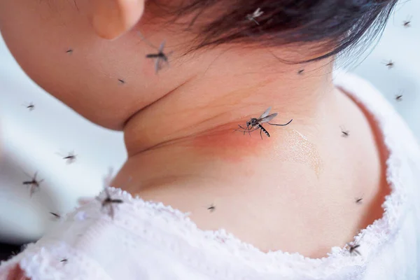 Lindo Asiático Bebé Chica Has Erupción Alergia Cuello Piel Mosquito — Foto de Stock